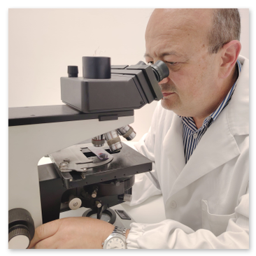 Dettaglio in primo piano del Professor Alfonso Baldi medico chirurgo specializzato in anatomia patologica nel  laboratorio di Orchidea Lab a Roma mentre esamina dei campioni al microscopio
