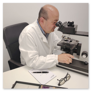 Il professorBaldi Alfonso mentre esamina campioni al microscopio e redige il referto istologico 